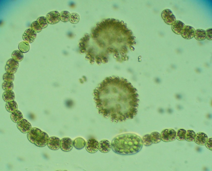 Blauwalg onder de microscoop Blauwalg onder de microscoop